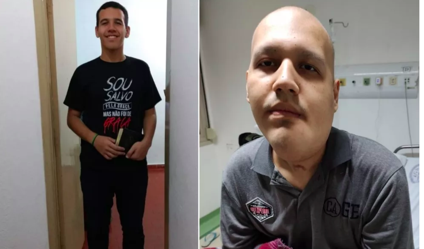jovem com câncer