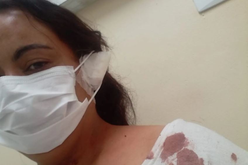 Som alto acaba em briga e orelha mordida em Bertioga