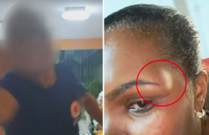 Enfermeira de casa de repouso e agredida no rosto por socorrista do Samu em Santos, SP