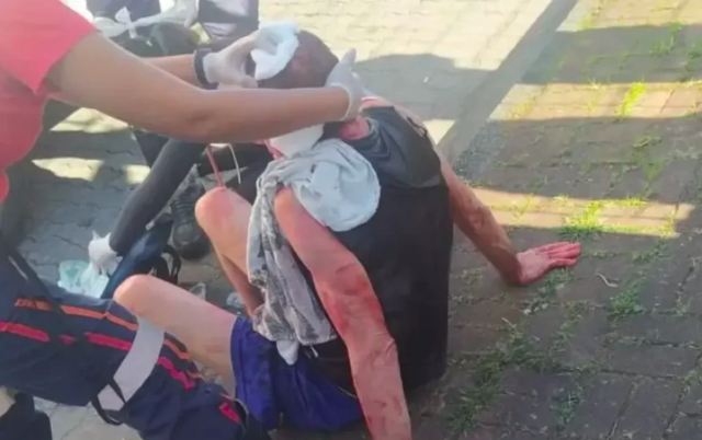 Idoso ferido por peladão de cubatão