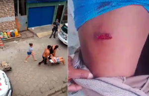 Moradores são baleados durante perseguição policial em Cubatão, SP