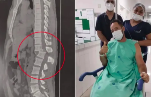 Aluno que foi atingido por aparelho em academia volta a sentir as pernas