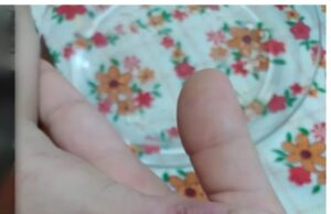 Criança de 5 anos retorna da creche com machucados e professor é acusado em São Vicente