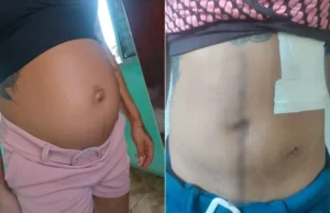 Gravida alvejada pelo ex perde bebê e descobre após enterro em Praia Grande(SP).