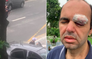 Advogado é agredido em avenida durante tentativa de assalto em São Vicente, SP