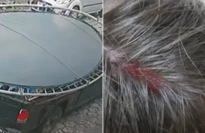 Criança de 11 anos fica ferida por conta de cama elástica mal colocada e transportada