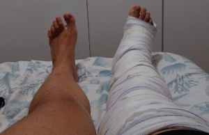 Jovem sofre fratura na perna após ataque de arrastão em praia do litoral de SP