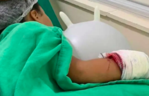 Uma criança é atingida no braço por disparo de arma de fogo em confronto entre PMs e criminosos em Cubatão, SP