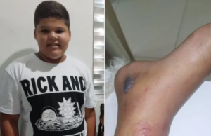 Menino de 12 anos morre após fraturar tornozelo e família acusa hospitais de negligência