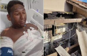 Homem tem 81% de corpo queimado após explosão causada por gás de cozinha em São Vicente, SP