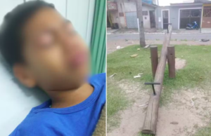 Criança de 7 anos rasga os testículos em gangorra de parquinho em Praia Grande, SP