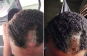 PMs são acusados de raspar cabelo de adolescente com facão em comunidade de São Vicente, SP