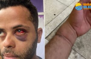 Homem diz ter sofrido agressões durante abordagem, no litoral SP