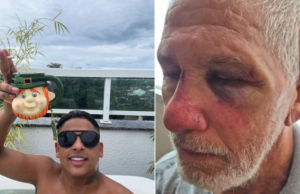 Idoso espancado por motorista de Porsche fica “indignado” com o parecer judicial