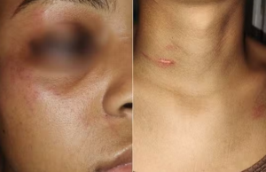 Ex-funcionária do McDonald’s é agredida por cliente pede indenização de R$ 100 mil