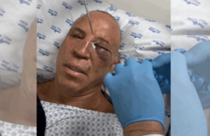 ‘Dor de cabeça que não passa’, diz Wanderlei Silva após nocaute em briga