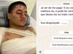 Homem é queimado com água fervendo ao invadir casa da ex no litoral de SP.