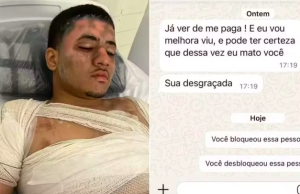 Homem é queimado com água fervendo ao invadir casa da ex no litoral de SP.